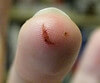 Cut Finger Hurts Paper cuts can be healed with time and an active immune system